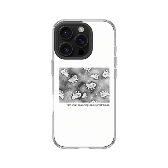 Microscopic Observation - White