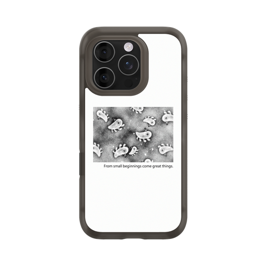 Microscopic Observation - White