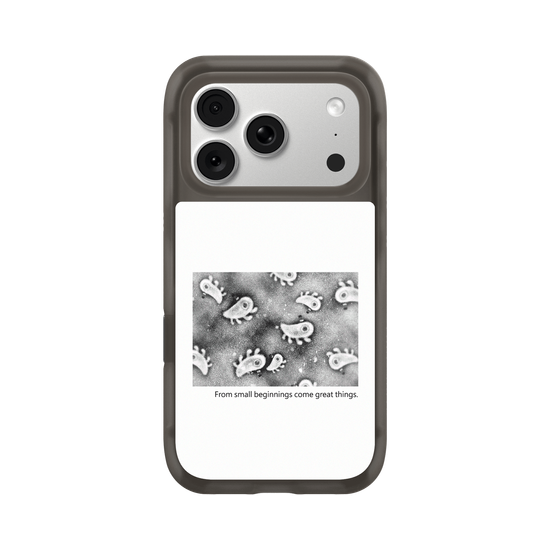 Microscopic Observation - White